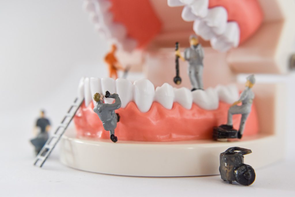 miniature people to repair a tooth or small figure worker cleaning tooth model as medical and healthcare. Idea for cleaning dental care or dentist.